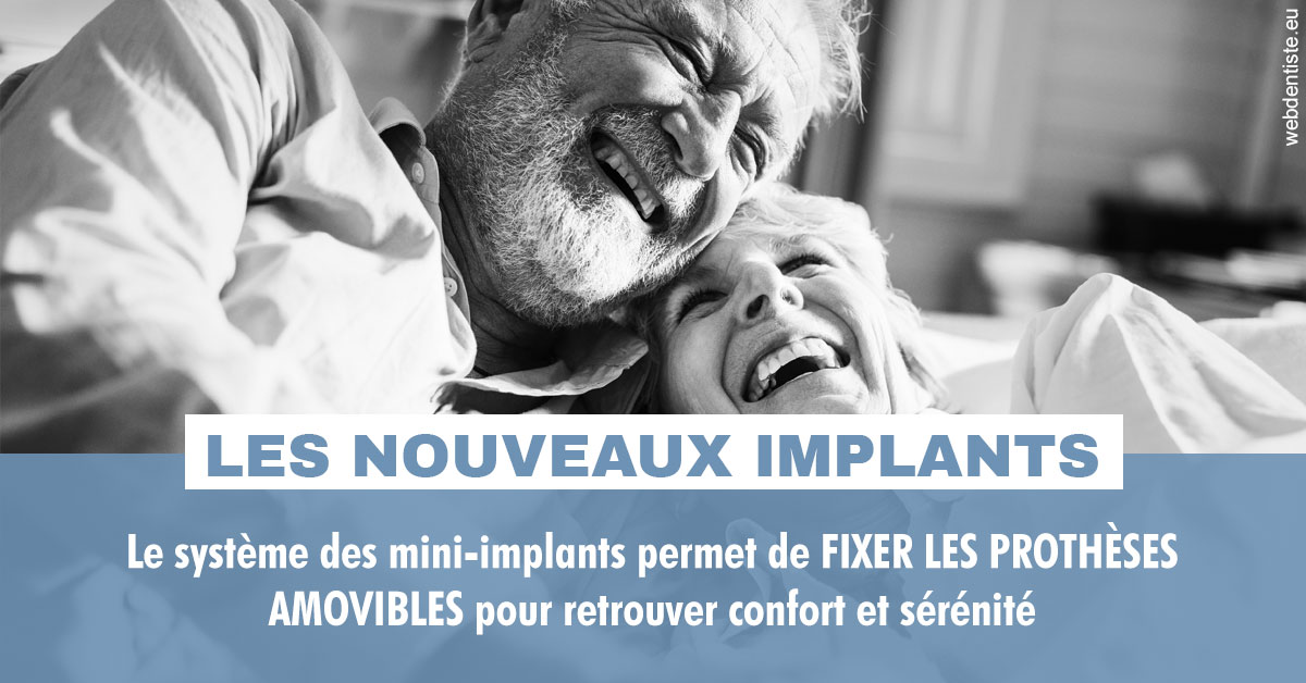 https://selarl-sabban.chirurgiens-dentistes.fr/Les nouveaux implants 2