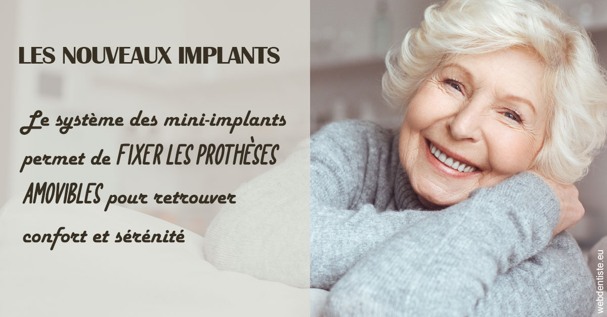 https://selarl-sabban.chirurgiens-dentistes.fr/Les nouveaux implants 1