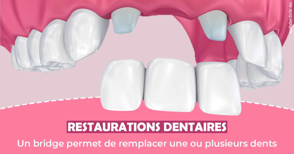 https://selarl-sabban.chirurgiens-dentistes.fr/Bridge remplacer dents 2