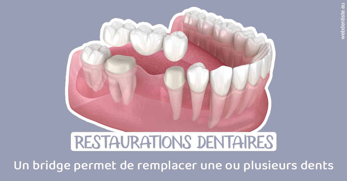 https://selarl-sabban.chirurgiens-dentistes.fr/Bridge remplacer dents 1