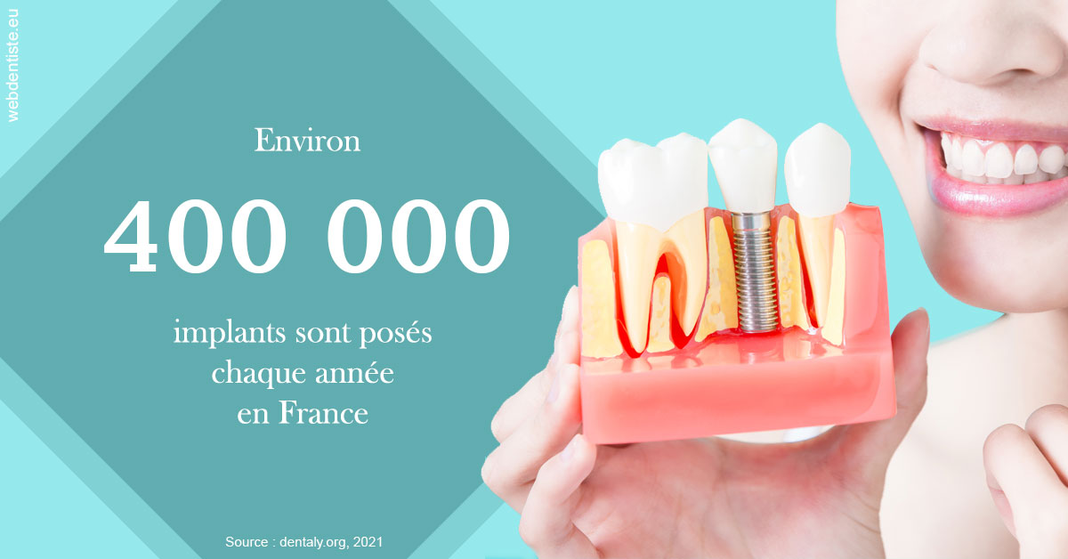 https://selarl-sabban.chirurgiens-dentistes.fr/Pose d'implants en France 2