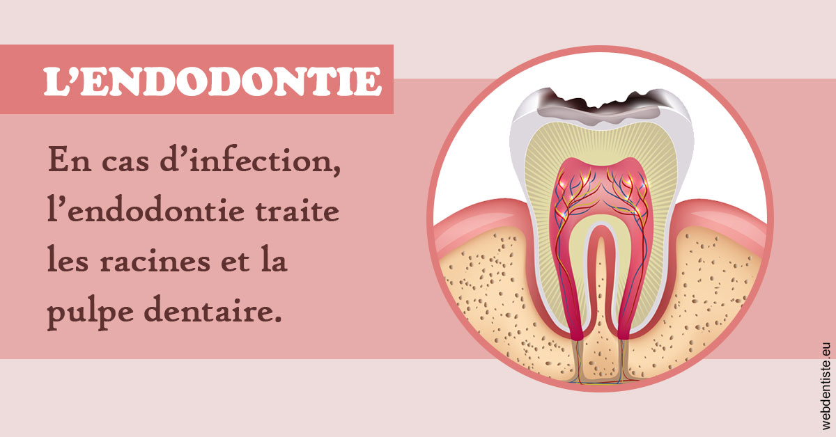 https://selarl-sabban.chirurgiens-dentistes.fr/L'endodontie 2
